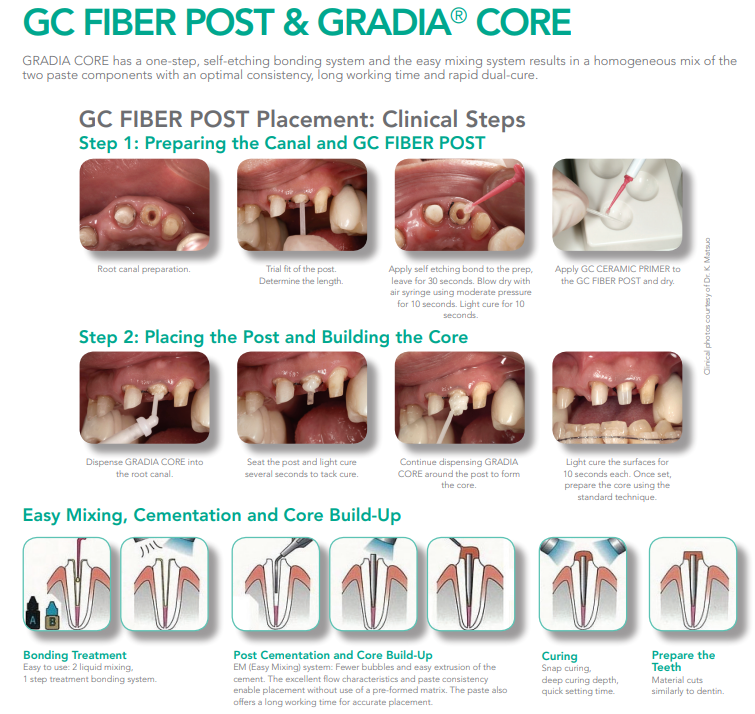 Image result for GC Self Core